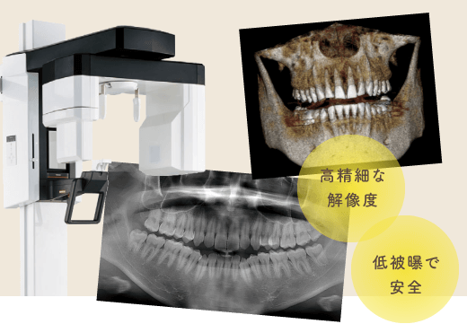 高精細な解像度、低被曝で安全